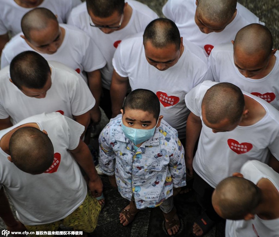 Eleven Chinese fathers who have their heads shaved set up a bald father supporting group for those children with leukemia in China. (Photo/ CFP)