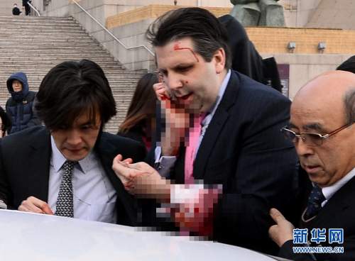 Knife attacker of U.S. ambassador to South Korea jailed for 12 years