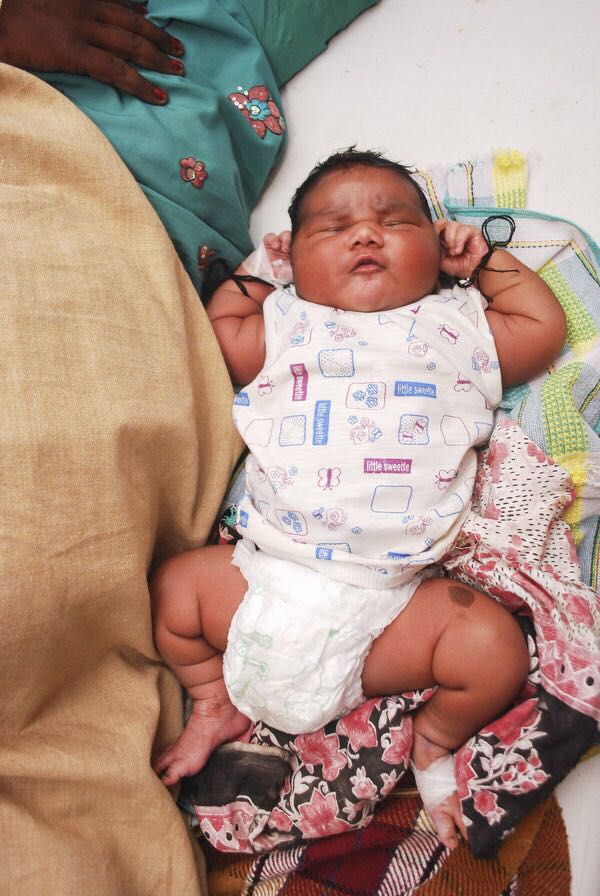 India’s Heaviest Baby Born at 13.2 Pounds