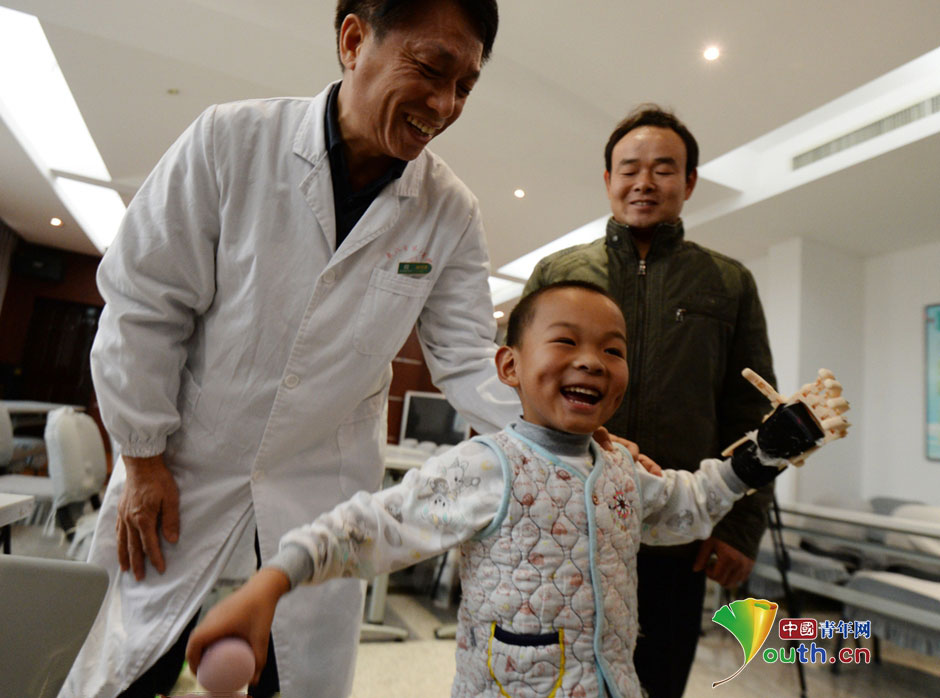 Boy regains his hand thanks to 3D printing