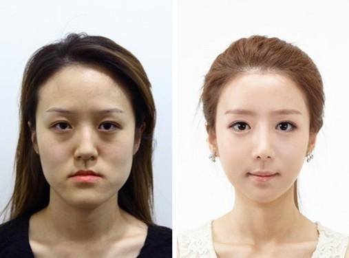 China to be the third largest country of plastic surgery