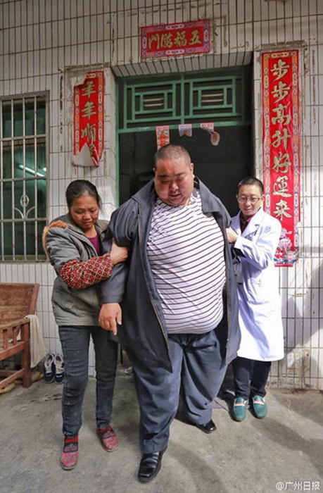 China's fattest man weighs 261kg