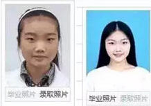 Did the students get plastic surgery?
