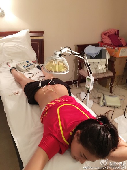 To sleep better at night, diving athlete receives acupuncture treatment 