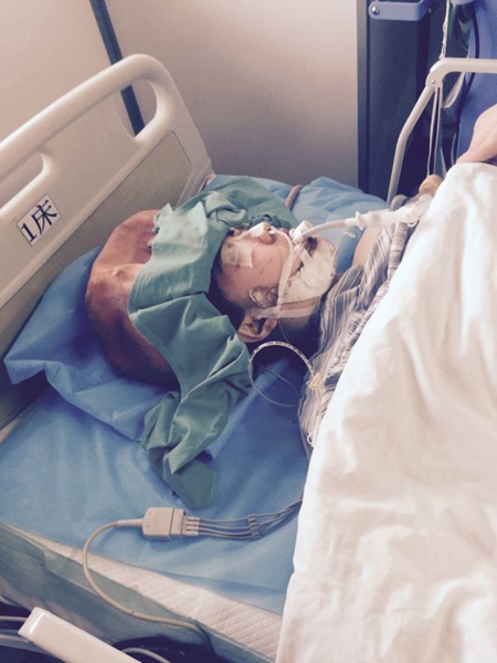 Returnee suffers from epilepsy after plastic surgery