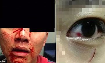 Auckland police's inaction in brutal assaults cases against Asian students questioned