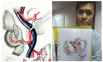 A doctor and an artist: young surgeon in Jiangsu goes viral