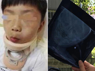 Kindergarten teacher instigates fighting to release energy