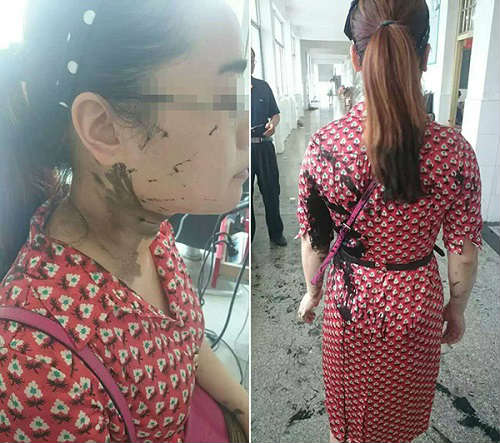Student caught cheating splashes ink on teacher, claims legal immunity