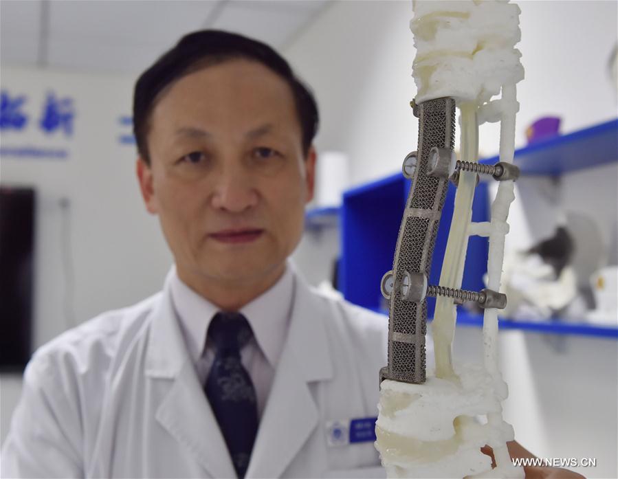 China Focus: Chinese doctors succeed in rare 3D-printed vertebrae implant