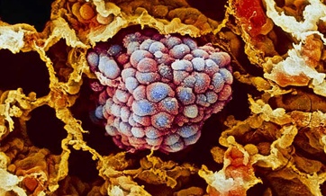 China tests controversial 'cut and paste' gene-editing technique on a human in a world first