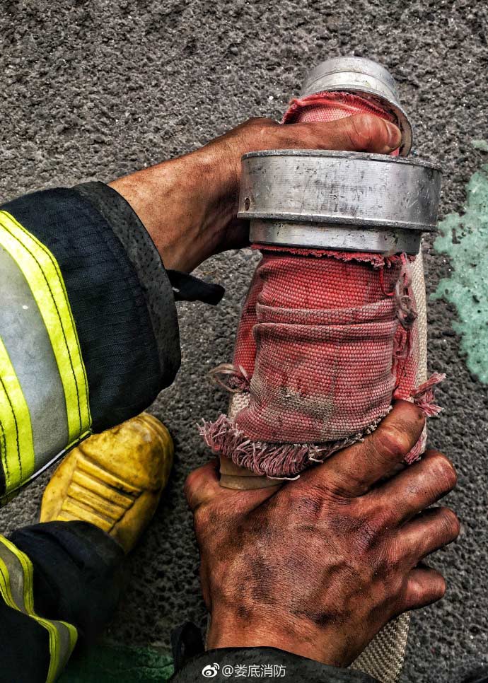 Fire fighters’ burn scars win respect