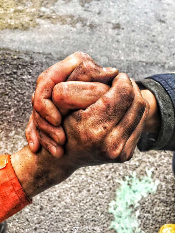 Fire fighters’ burn scars win respect