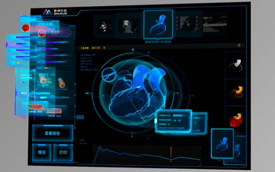 AI leads drive for Healthy China