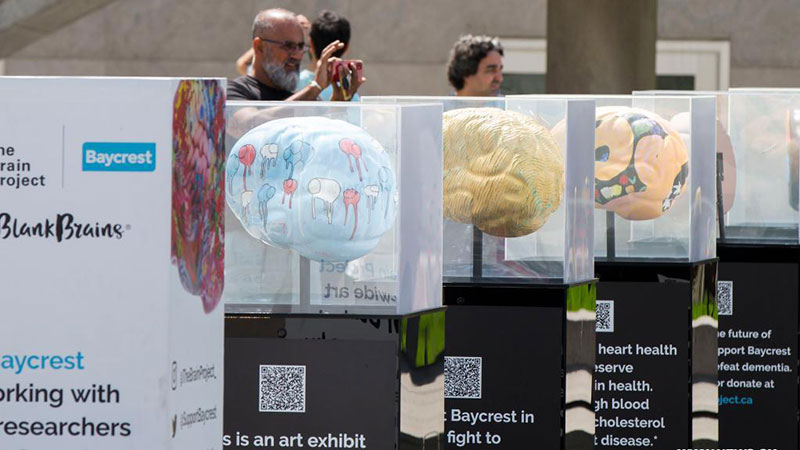 Brain Project art exhibition held in Toronto, Canada
