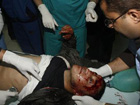 One killed, 4 wounded in Israeli airstrike on Gaza 