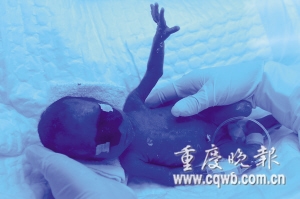 Smallest test-tube baby born in Chongqing