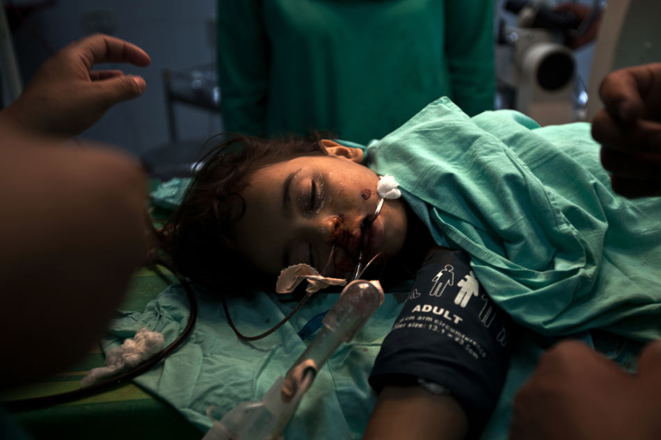 A wounded Palestinian girl receives treatment in al-aqsa hospital after an Israeli air strike in the Central Gaza Strip, on Nov. 18, 2012. (Xinhua/AFP)