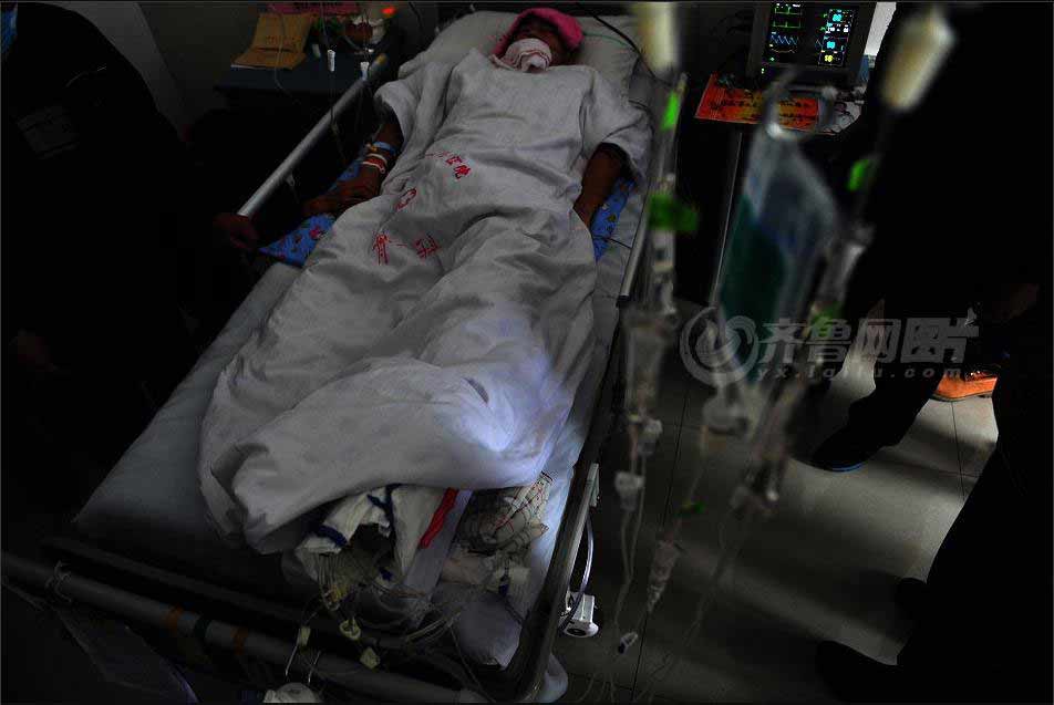 Gong Yuben lies in bed at a central hospital in Zaozhuang city of Shandong province on Nov. 22. he never thought he has lost his right leg . (iqilu.com/Zhang Xiaobo)