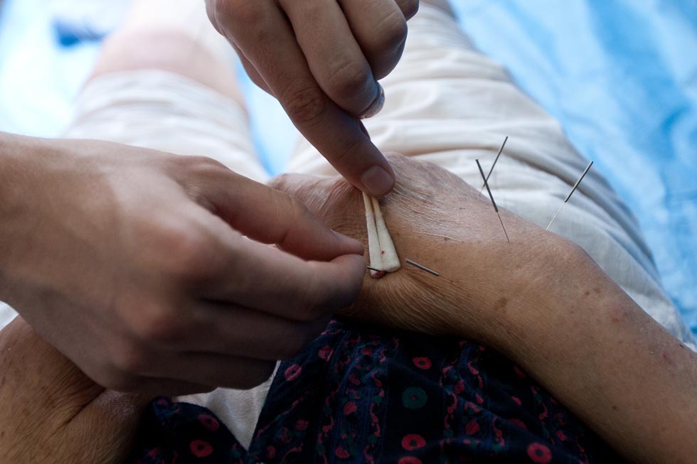 Florian Paillard extracts needles after giving acupuncture treatment to a patient at the Acupuncture and Moxibustion Hospital of Anhui University of Traditional Chinese Medicine in Hefei, capital of east China's Anhui Province, May 18, 2012.(Xinhua/Liu Junxi)