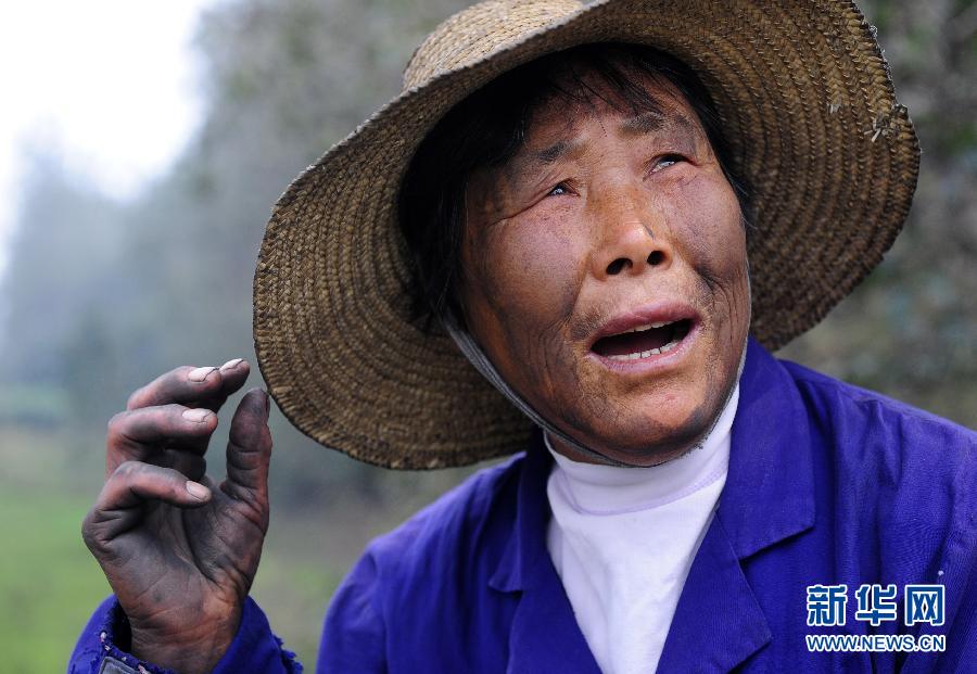 After picking cotton, Dong Lanying's face is covered by ash on Sept. 23, 2012. （Xinhua/Hao Tongqian）