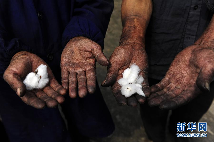 Hands of villagers after picking cotton. (Xinhua/Hao Tongqian)