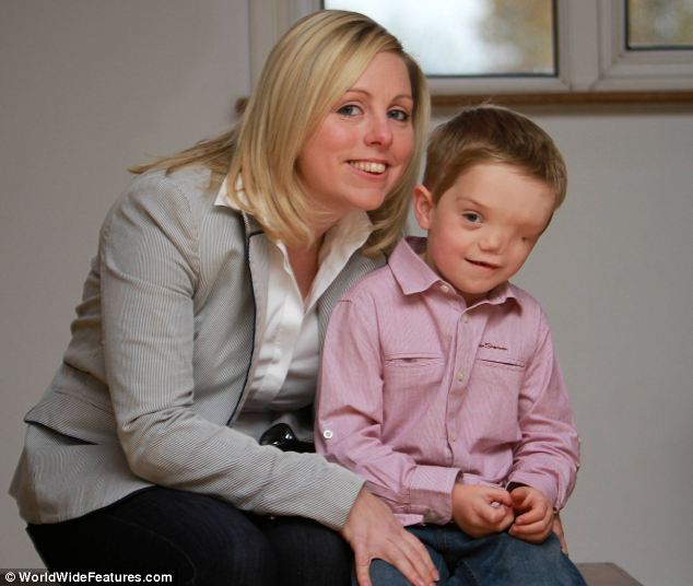 The 33-year-old British mother Charlene Machin had given birth to twin boys Oliver and Harry, but doctors discovered baby Harry had been born with a severe facial deformity, according to newspaper Daily Mail. Charlene and her two sons have overcome other people's prejudices and are a loving, close family. (Photo Source: huanqiu.com)