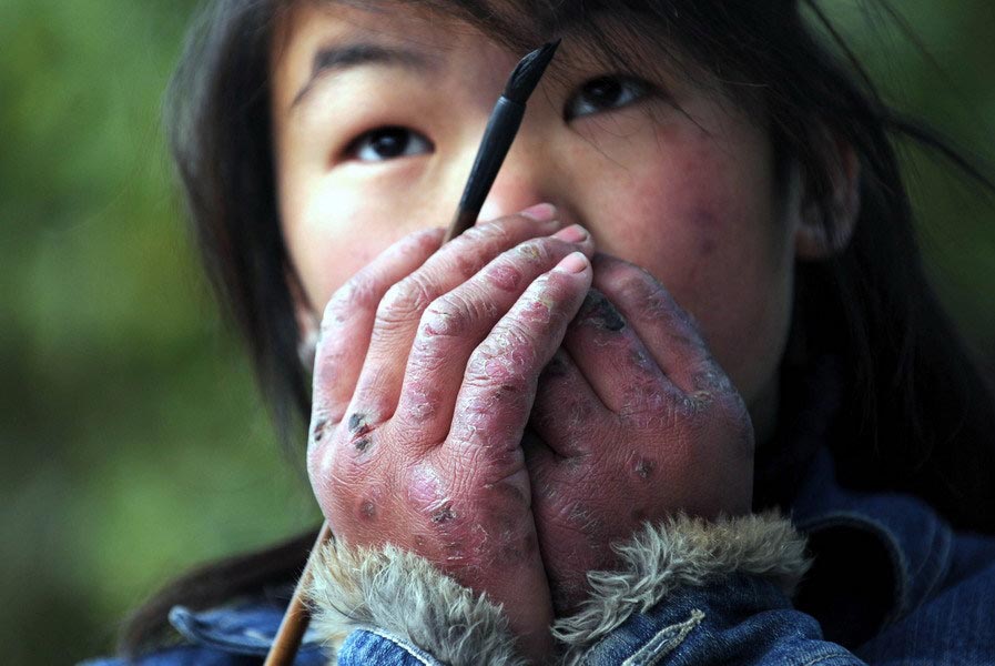 Xiao Qing, a 15-year-old girl from Boyang County, Jiangxi Province, is painting at a food market in Haining New District, Zhejiang, on Feb. 11, 2011. In the case of freezing cold, she has to occasionally blow on her frostbitten hands. In order to enrich her life during winter vacation, Xiao Qing decided to simply draw in the streets. Though her paintings do tend to attract a crowd, these usually consist of mere onlookers, not buyers. She believes that one more painting can lead to one more opportunity for progress. (Zhejiang Daily/Chu Yongzhi)