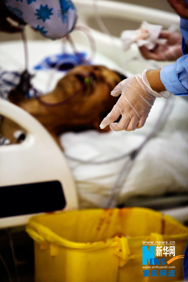 Doctors and nurses treat a patient with massive hematemesis.(Xinhua/Peng Bo)