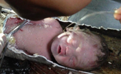 Baby abandoned in toilet pipe rescued
