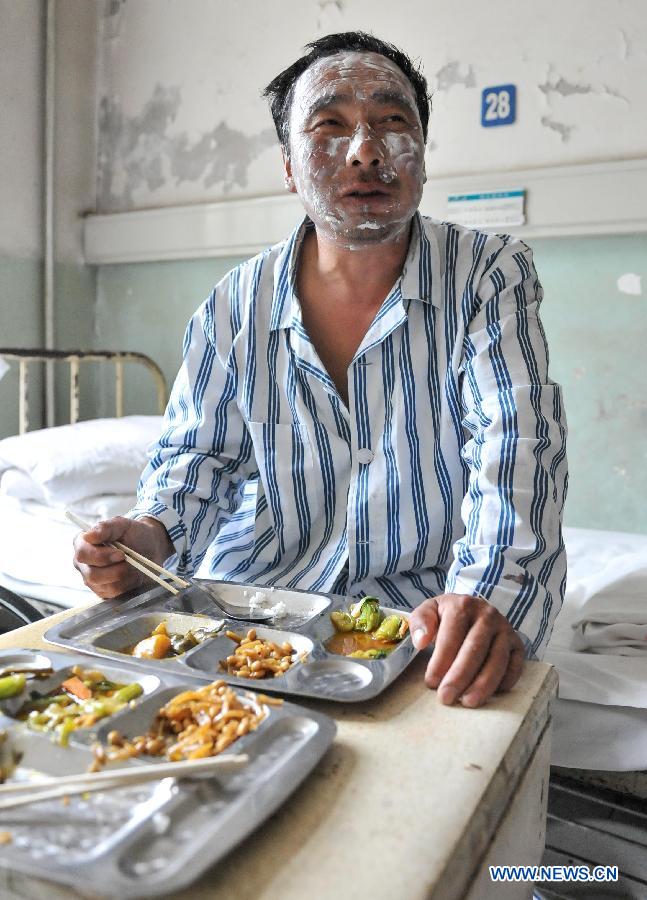 Xia Weigang, a man injured in a fire accident, takes lunch in hospital in Changchun, capital of northeast China's Jilin Province, June 5, 2013. A fire broke out at a poultry processing workshop owned by the Jilin Baoyuanfeng Poultry Company in Mishazi Township in the city of Dehui on early Monday morning. The fire killed 120 people and injured 77 others. (Xinhua/Wang Haofei) 