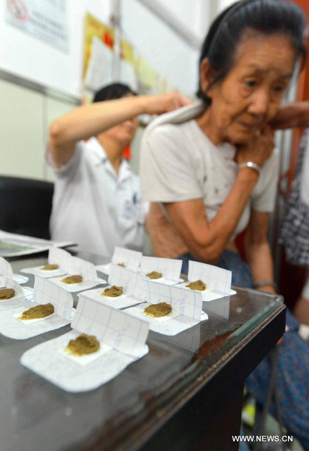 A doctor applies herb sticks to acupuncture points in hot summer days onto a citizen at a hospital in Tangshan, north China's Hebei Province, July 13, 2013. Saturday marks the beginning of the hottest part of summer. Many people go to their local hospitals of traditional Chinese medicine to apply herb sticks to acupuncture points to prevent diseases. (Xinhua/Zheng Yong)